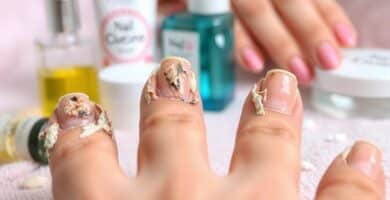 what causes rag nails