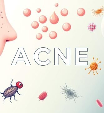 can acne go away on its own without treatment