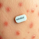 does estradiol patch cause acne