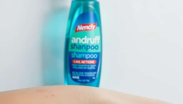does dandruff shampoo help acne