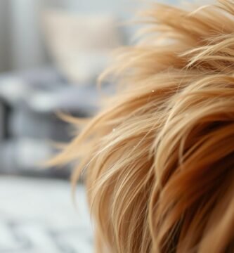 how to treat dandruff in dogs naturally