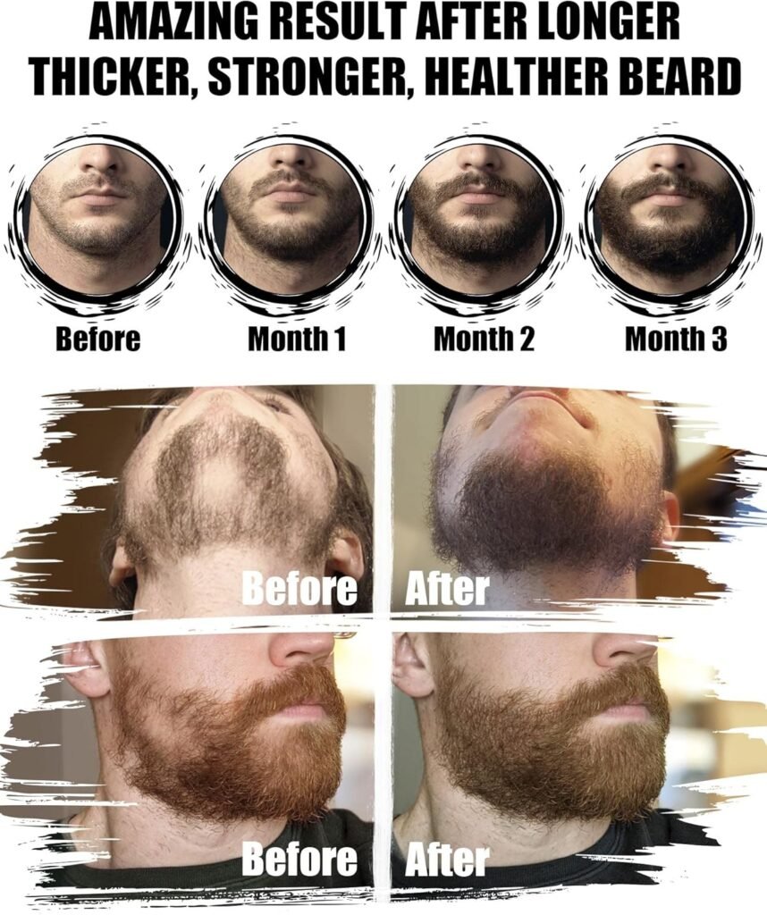Beard Grooming Kit, Beard Oil and Balm, Beard Wash  Conditioner, Beard Brush Set with Comb Scissors, Gifts for Men, Valentines Gifts for Him, Mens Birthday Gifts for Dad, Stocking Stuffers